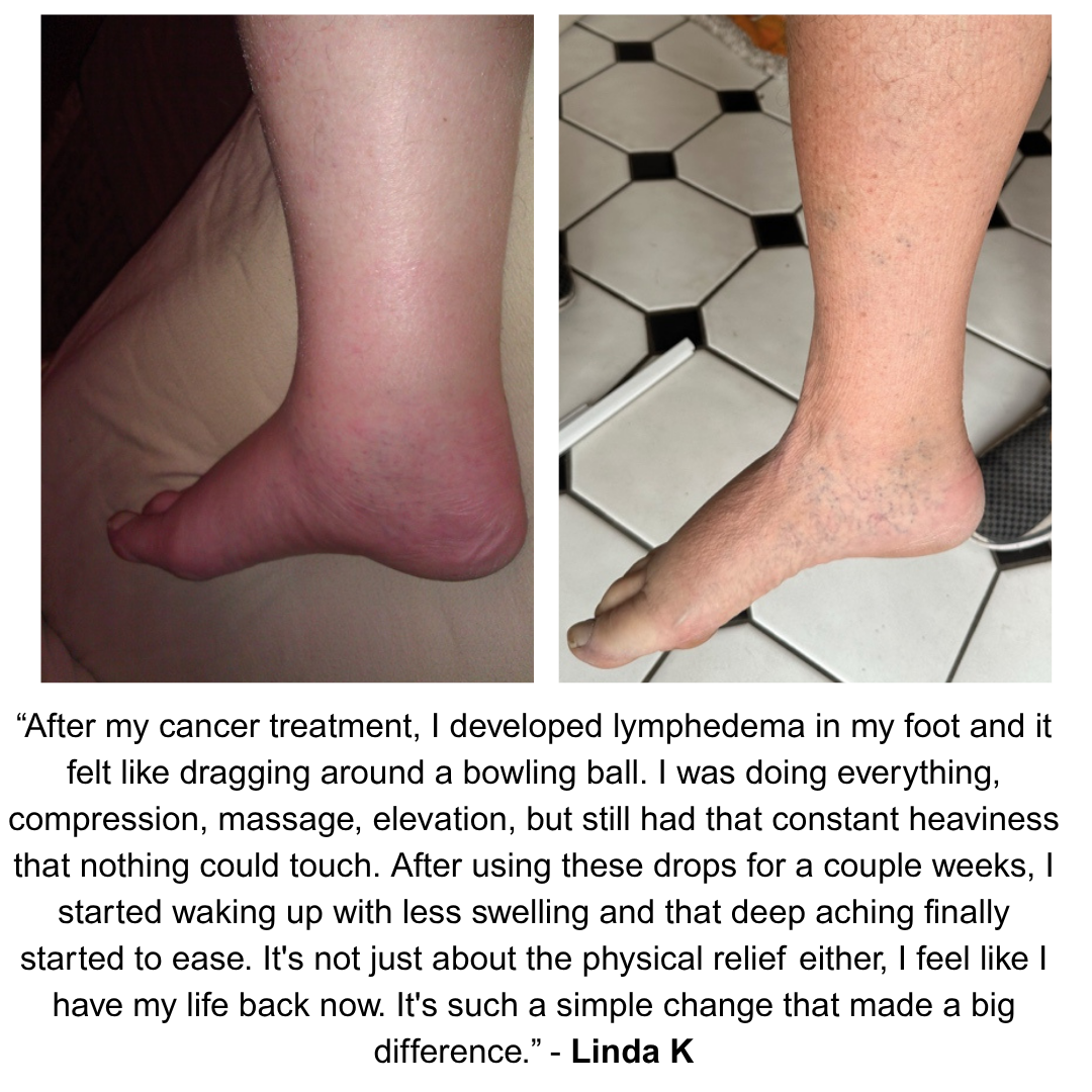 Lymphedema Wellness Drops™