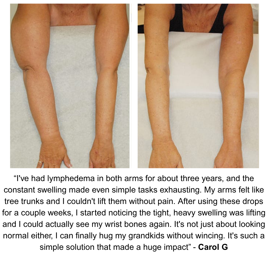 Lymphedema Wellness Drops™